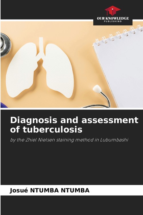 Diagnosis and assessment of tuberculosis