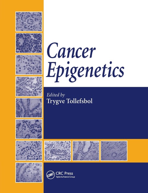 Cancer Epigenetics