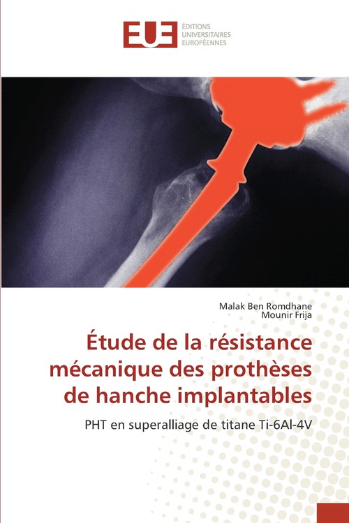 Étude de la résistance mécanique des prothèses de hanche implantables