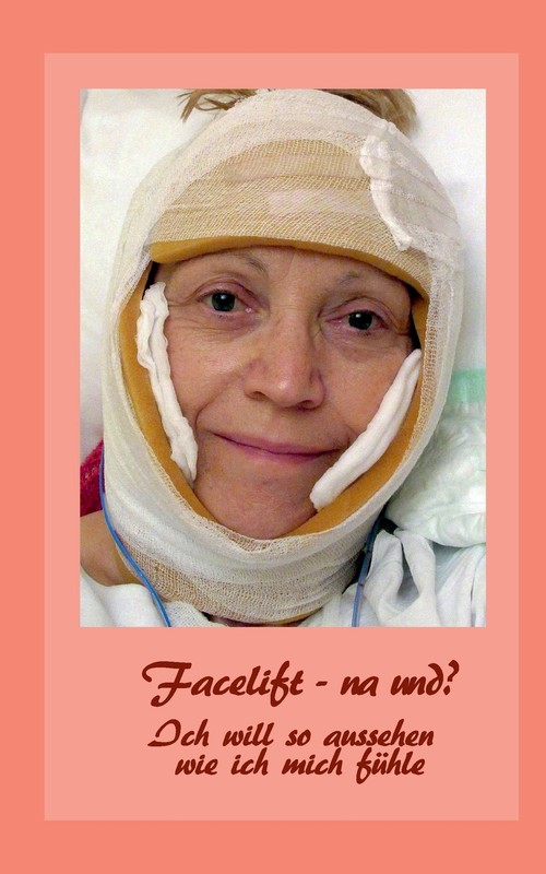 Facelift - na und?